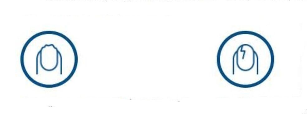 deformação das unhas devido a infecção fúngica